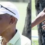 Barack Obama Shows Up to Golf with Black Eye, Bandaged Hand After Death of Personal Chef